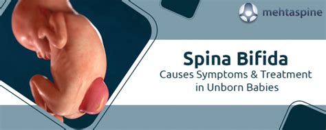 bofuda|Spina Bifida: Causes, Symptoms, Diagnoses, and Treatment